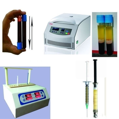 6/8x15ml Portable PRP Centrifuge Device 0-4000rpm Untuk Rumah Sakit Bedah Kosmetik