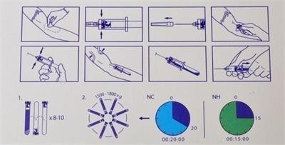 6/8x15ml Portable PRP Centrifuge Device 0-4000rpm Untuk Rumah Sakit Bedah Kosmetik